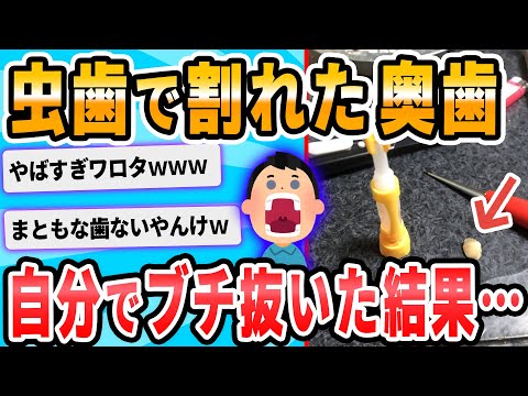 【2ch面白いスレ】虫歯で割れた奥歯をぬこうとしてるだけなのに血だらけ