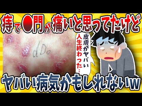 【2ch面白いスレ】痔で●門が痛いと思ってたけど別のヤバい病気かもしれないwwww【ゆっくり解説】