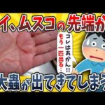 【2ch面白いスレ】ワイ、ムスコの先端から巨大な蟲が出てきてしまうwwww【ゆっくり解説】